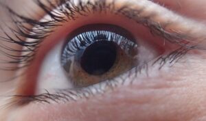 Distacco della retina: come si manifesta?