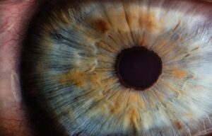 Lesione alla cornea: cause più comuni
