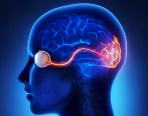 La neurite ottica o retrobulbare è l'infiammazione del nervo ottico