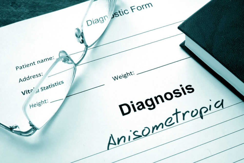 Anisometropia e Aniseiconia: cosa sono?