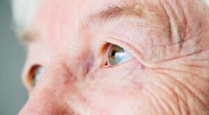 Membrana epiretinica maculare: cos’è?