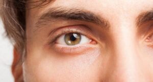 Vene rosse negli occhi provocate dai capillari rotti: devo preoccuparmi?