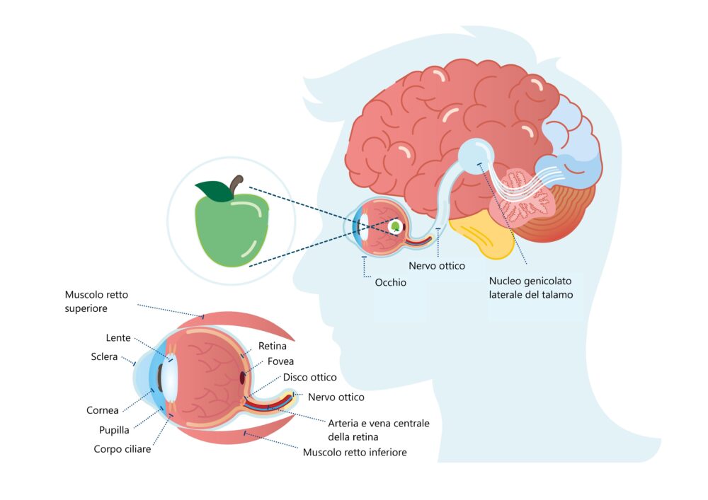 alterazioni neuroftalmologiche