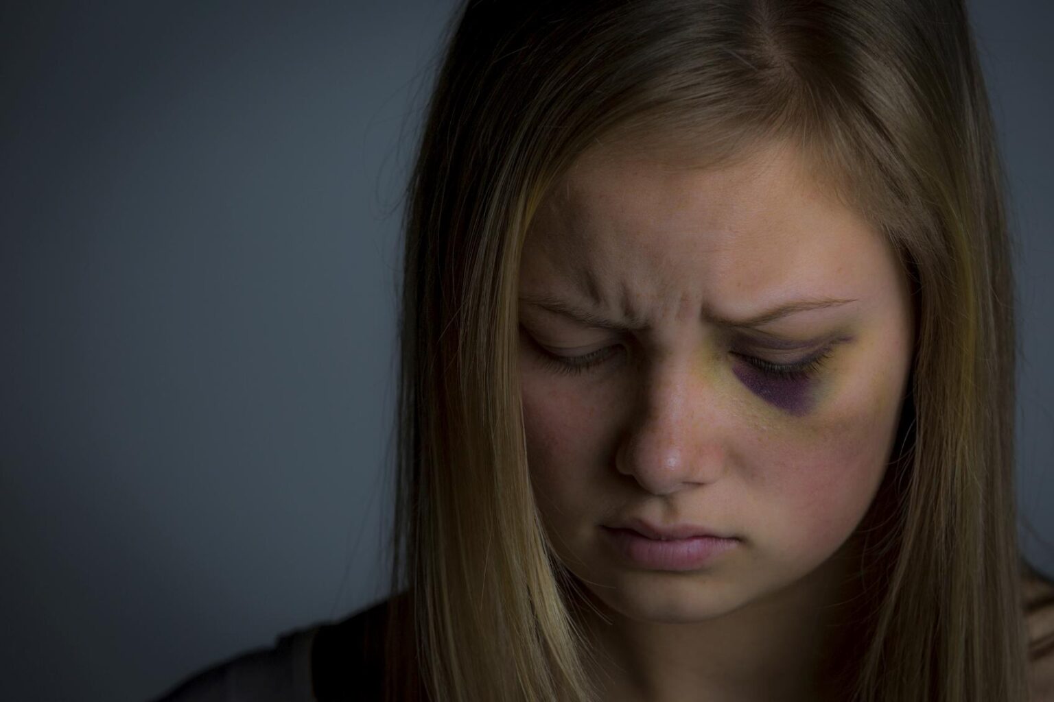Colpo all'occhio: che pericoli ci sono e come agire - Baviera Clinica ...