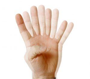 Che cos’è la diplopia o visione doppia?