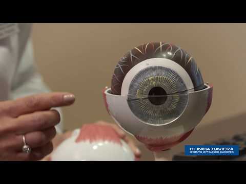 La presbiopia: come si cura