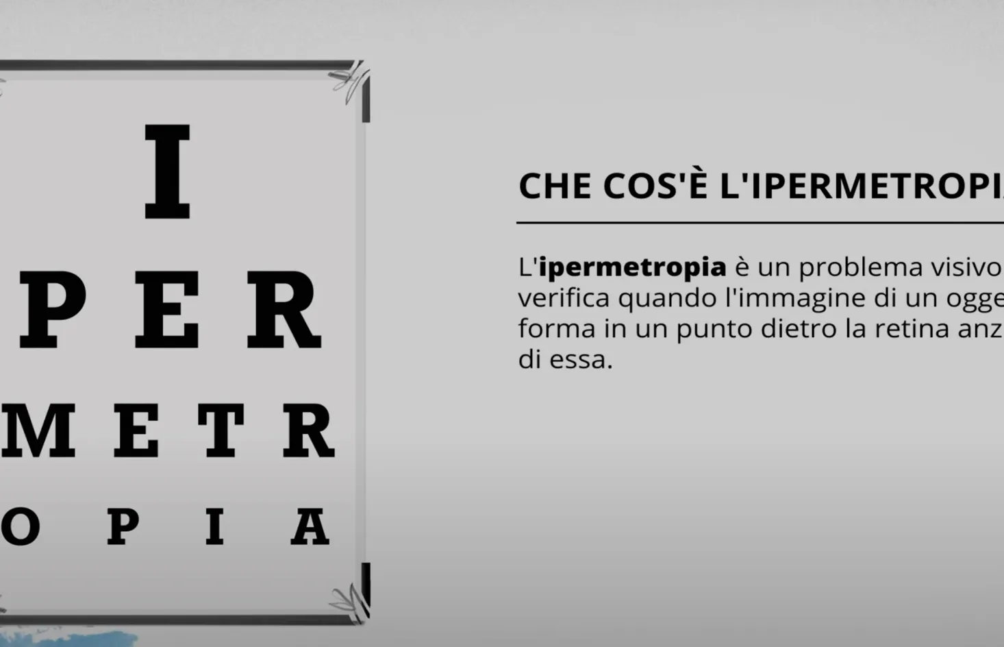 video cos´è l´ipermetropia